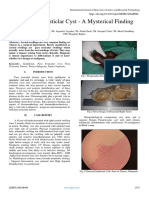 Benign Paratesticlar Cyst - A Mysterical Finding