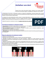 Dévitaliser Une Dent: Circonstances Nécessitant Un Traitement Canalaire