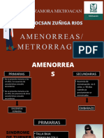 AMENORREA