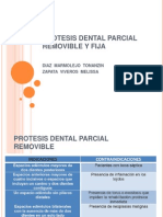 Protesis Dental Parcial Removible