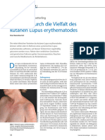 Leitfaden Durch Die Vielfalt Des Kutanen Lupus Erythematodes