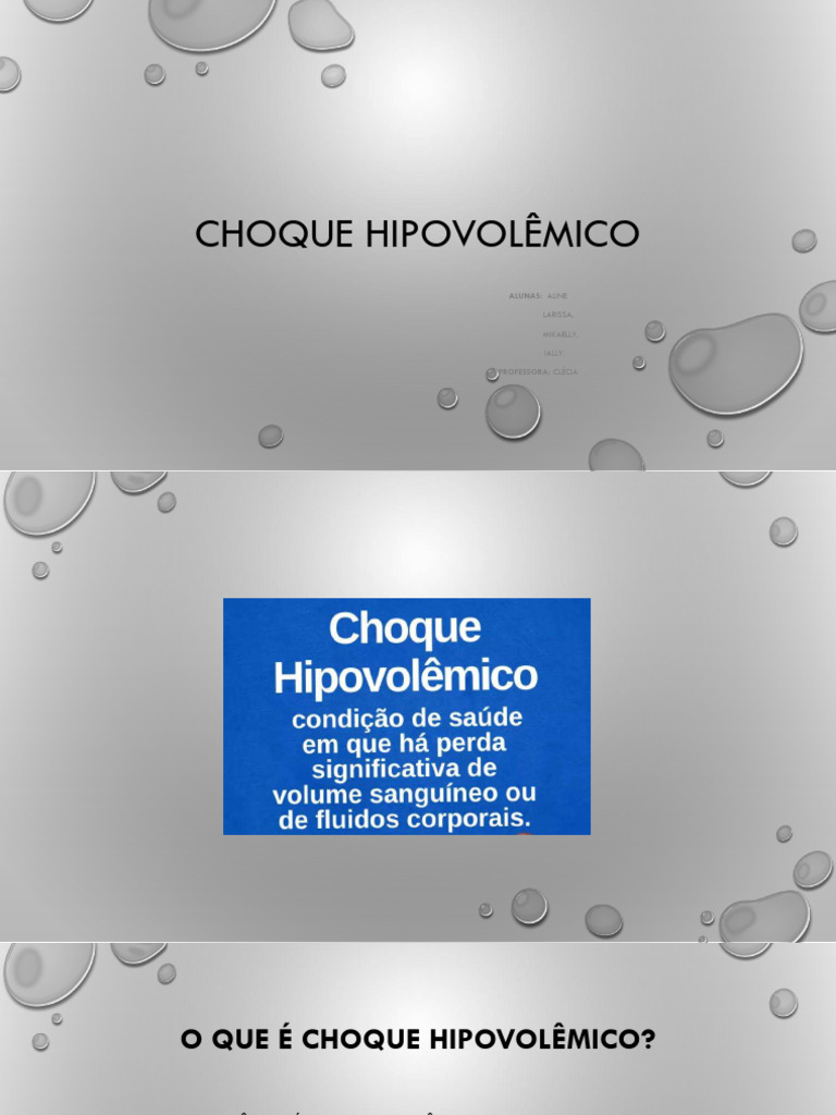 Choque Hipovolêmico: Causas e Tratamento | PDF | Choque (circulatório ...