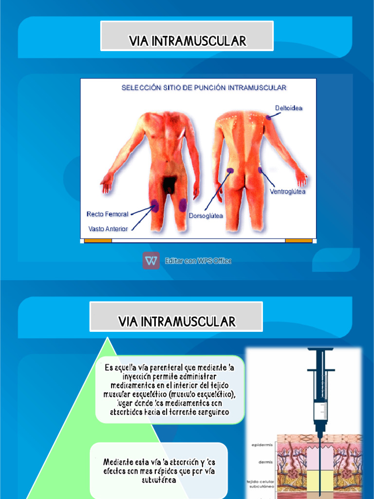 Guía Completa de Inyección Intramuscular | PDF | Inyección (medicina ...