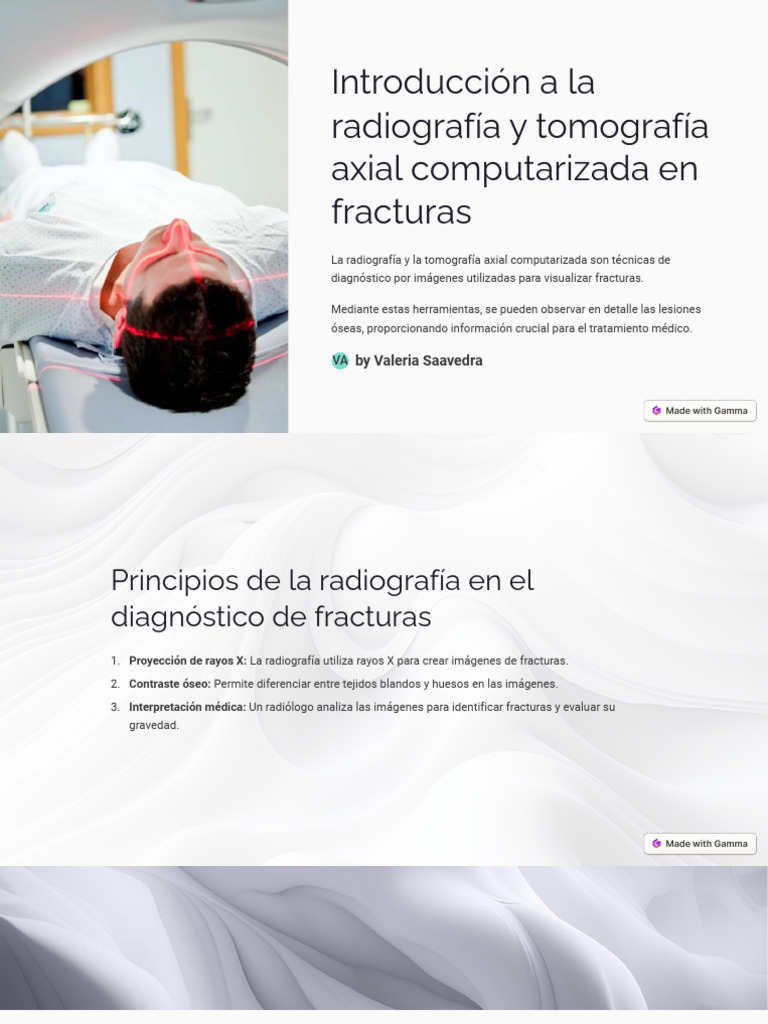 TAC y radiografía en fracturas óseas | PDF | Ct Scan | Radiología