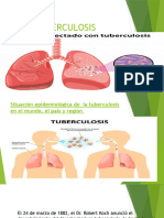 Tuberculosis