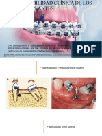 Aplicabilidad Clínica de Los Miniimplantes