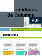 Deformidades de Columna - Potm