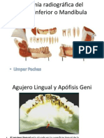 Radioanatomía Del Maxilar Inferior