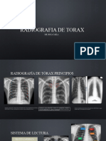 Radiografia de Torax