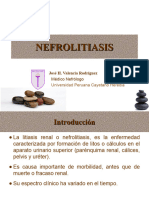 NEFROLITIASIS