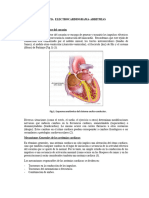 Lectura ECG-Arritmias