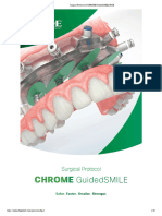 Surgical Protocol of CHROME GuidedSMILE ROE