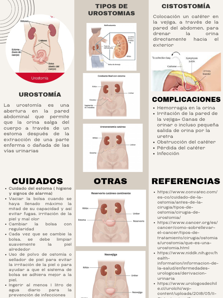 Tipos y cuidados de urostomías | PDF | Sistema genitourinario ...