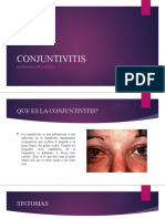 Conjuntivitis Vista