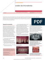 Microdontia Artigo TCC - En.pt