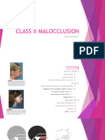 Class II Division 1 Malocclusion