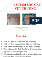 QLCS các loại vết thương