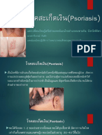 34-โรคสะเก็ดเงินPsoriasis1