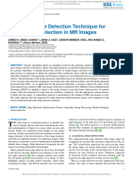 Optimized Edge Detection Technique For Brain Tumor