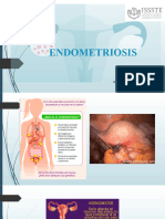 Endometriosis y Sindrome de Ovario Poliquistico