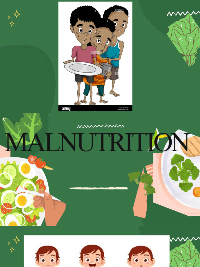 Malnutrition Pdf Malnutrition Vitamin