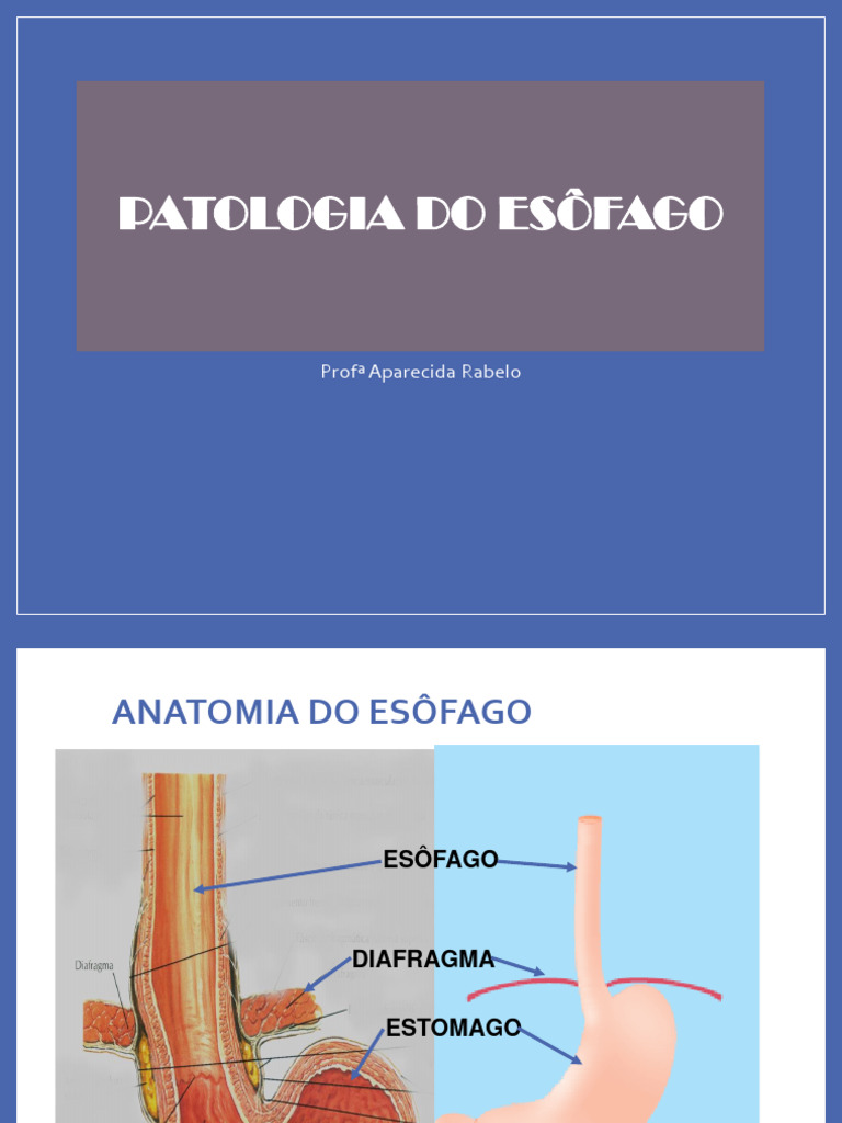 Anatomia e Patologias do Esôfago | PDF | Esôfago | Doença do refluxo ...