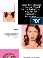 Vitiligo: Understanding The Etiology, Clinical Features, Lesion Types, Diagnosis, and Treatment in Dermatology