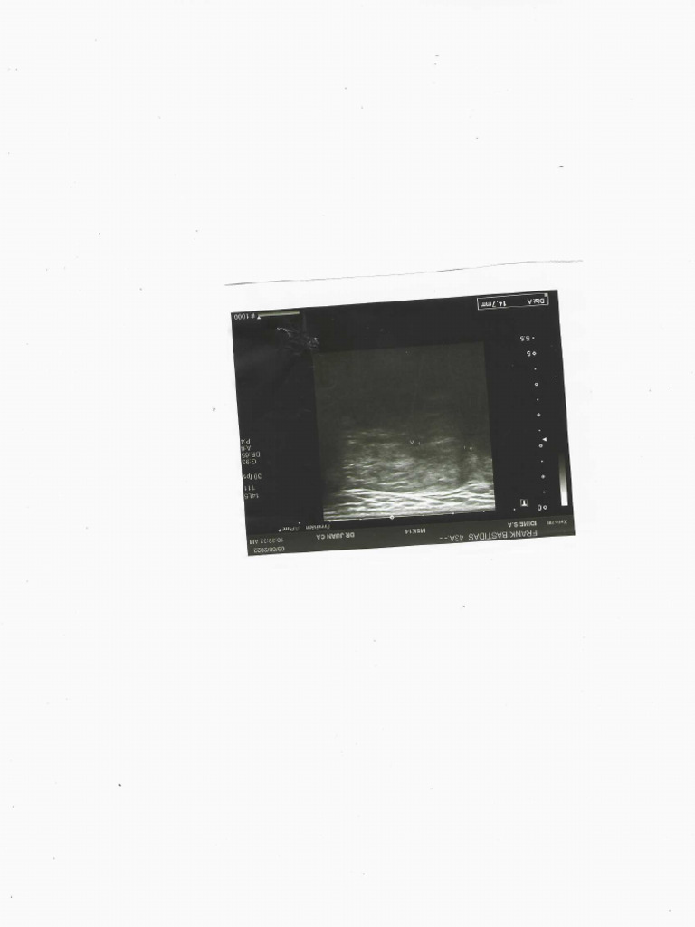 Scan | PDF