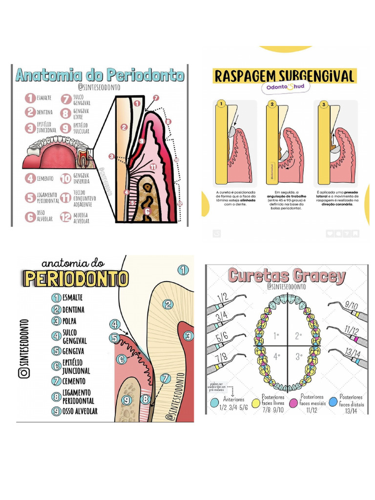 Imagens - Periodontia | PDF