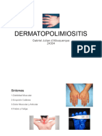 Dermatologia Polimiositis