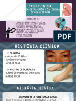 Glomerulonefritis Postestreptocócica