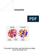 Leucemia