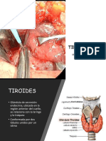 TIROIDECTOMIA