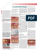 Article Les Urgences en Parodontologie Aonews 2016 Sylvie Pereira Paris .PDF-Adobe-Acrobat-pro