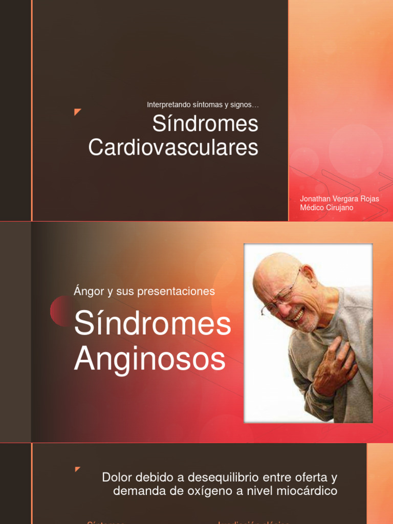 UDP - Angor y Sus Presentaciones | PDF | Infarto de miocardio ...