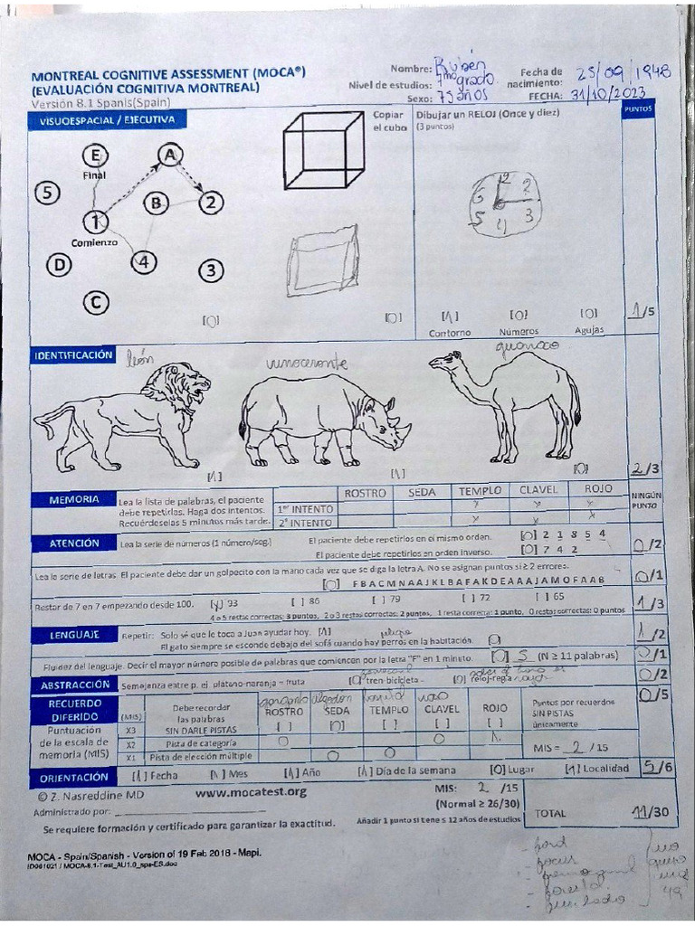 MoCA | PDF
