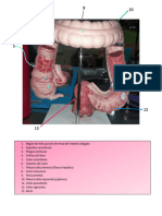 Anatomía de Intestino Grueso
