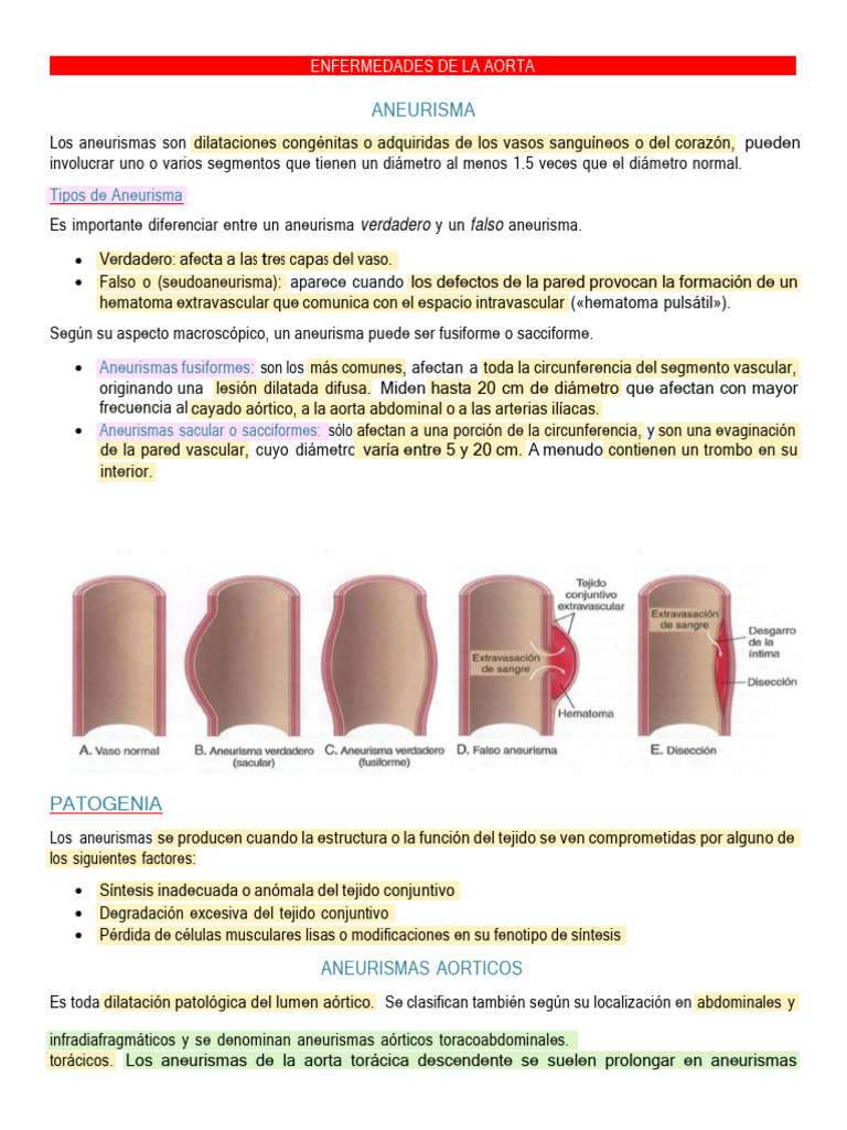 Aneurismas Aórticos: Tipos y Causas | PDF | Aorta | Aterosclerosis