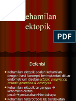 Kehamilan Ektopik