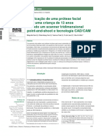 14. N. Fabricação de uma prótese facial para uma criança de 13 anos usando um scanner tridimensional point-and-shoot e tecnologia CADCAM