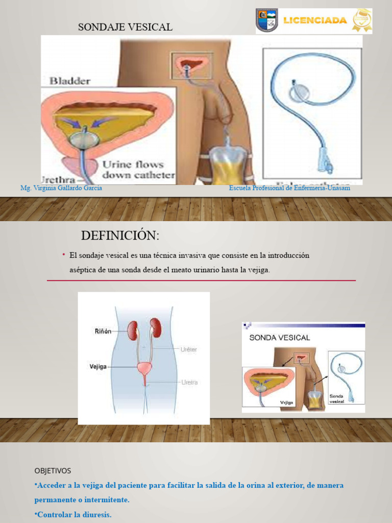 Cuidados y Procedimiento de Sondaje Vesical | PDF | Medicina CLINICA ...