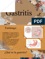 Gastritis Presentacion