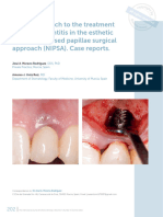 Apical Approach To The Treatment of Peri-Implantitis in The Esthetic Zone - Nonincised Papillae Surgical Approach (NIPSA) - Case Reports