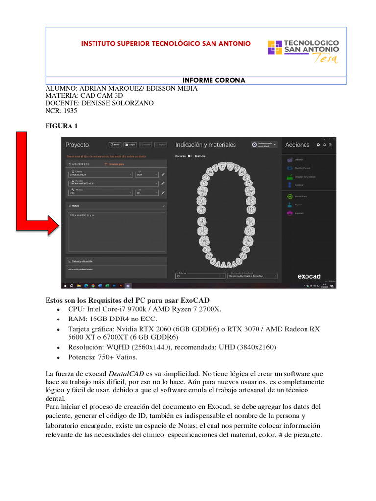 Corona CAD CAM | PDF | Archivo de computadora | Software