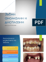 Аномалии в Зъбното Развитие и Зъбни Дисплазии 240108 171009