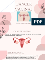 Cancer Vaginal