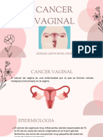 CANCER VAGINAL