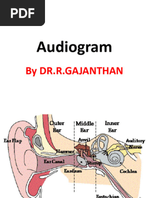 Audiogram-2