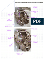 fotos meninges e vascularização