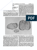 A Clinical Lecture On Total Extirpation of The Prostate For Radical Cure of Enlargement of That Organ - Freyers Technique